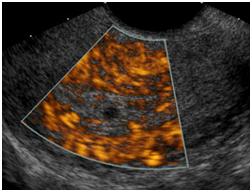 Ultrasound of the Pelvis1